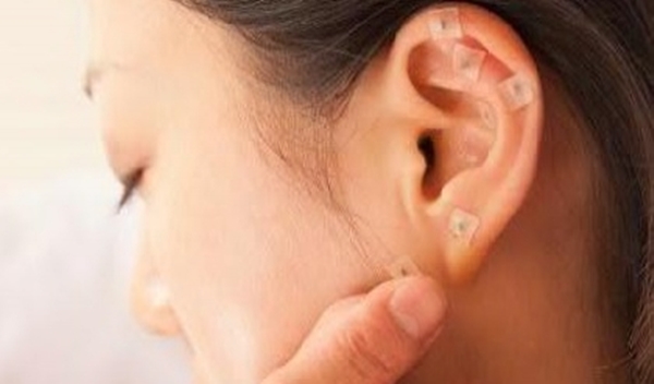 Auriculoterapia: A Arte de Equilibrar Corpo e Mente Através da Orelha
